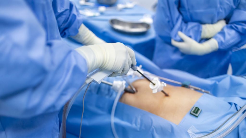 Acute cholecystitis - Treatment